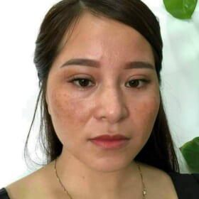 Viên uống hỗ trợ trắng sáng da Damian