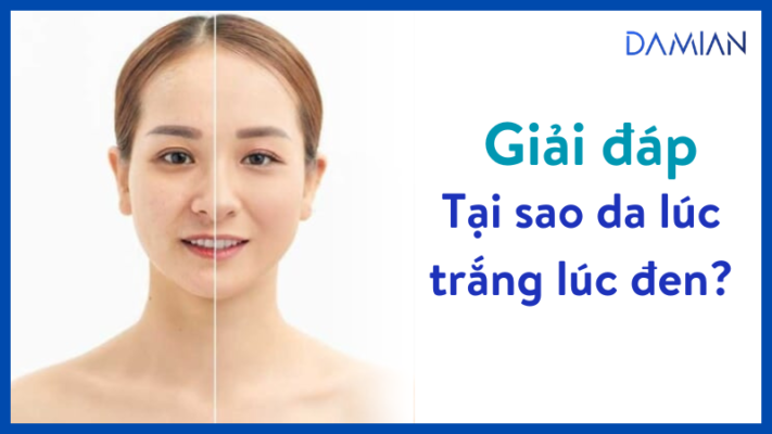 Tại sao da lúc trắng lúc đen