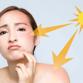 ra nắng bao lâu thì bị đen da