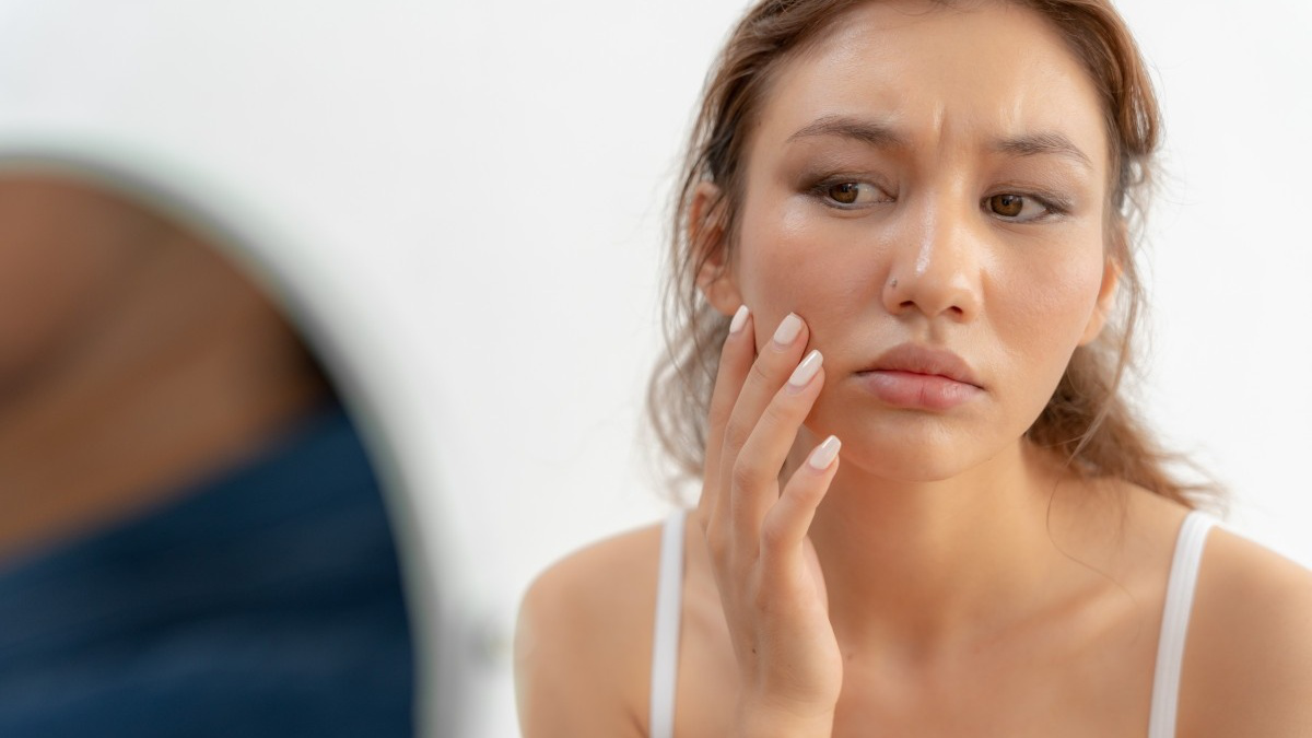 da xỉn màu là gì?