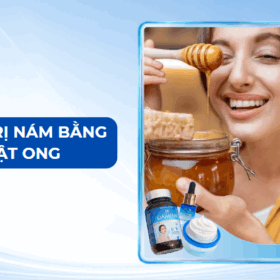 Top 5 cách trị nám bằng mật ong tại nhà giúp da đều màu